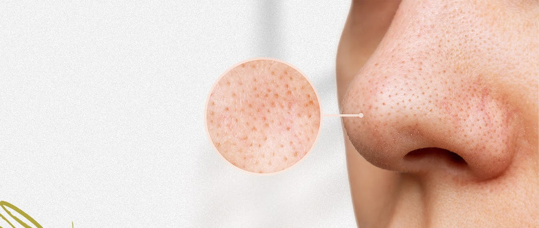 A woman with a small blackhead on her nose, illustrating a common skin concern addressed in skincare guides.